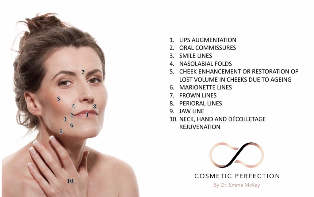 Dermal Fillers Areas Cosmetic Perfection