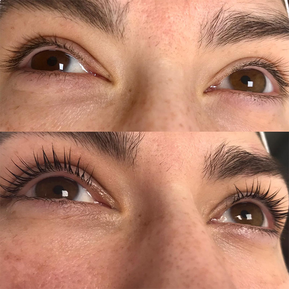 Lash Bomb - Aesthetics Clinic In Wirral & Heswall - Cosmetic Perfection