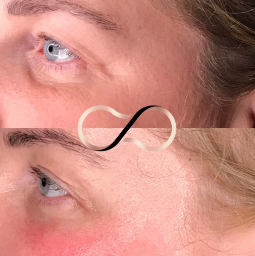 WOW Facial