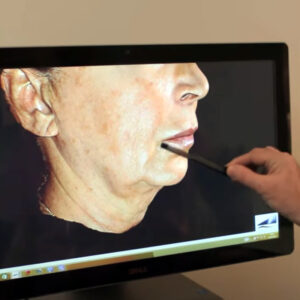 LifeViz Mini Skin Analysis Wirral Merseyside Cosmetic Perfection