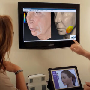 LifeViz Mini Skin Analysis Wirral Merseyside Cosmetic Perfection