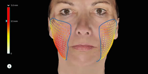 Lifeviz-Mini-Skin-Consultation-Wirral