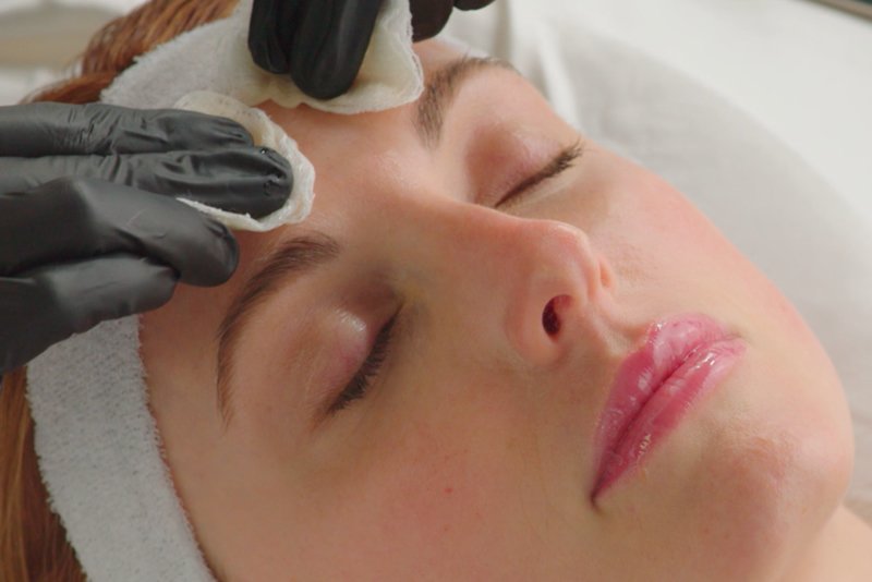 Revision BioStim™ Wirral